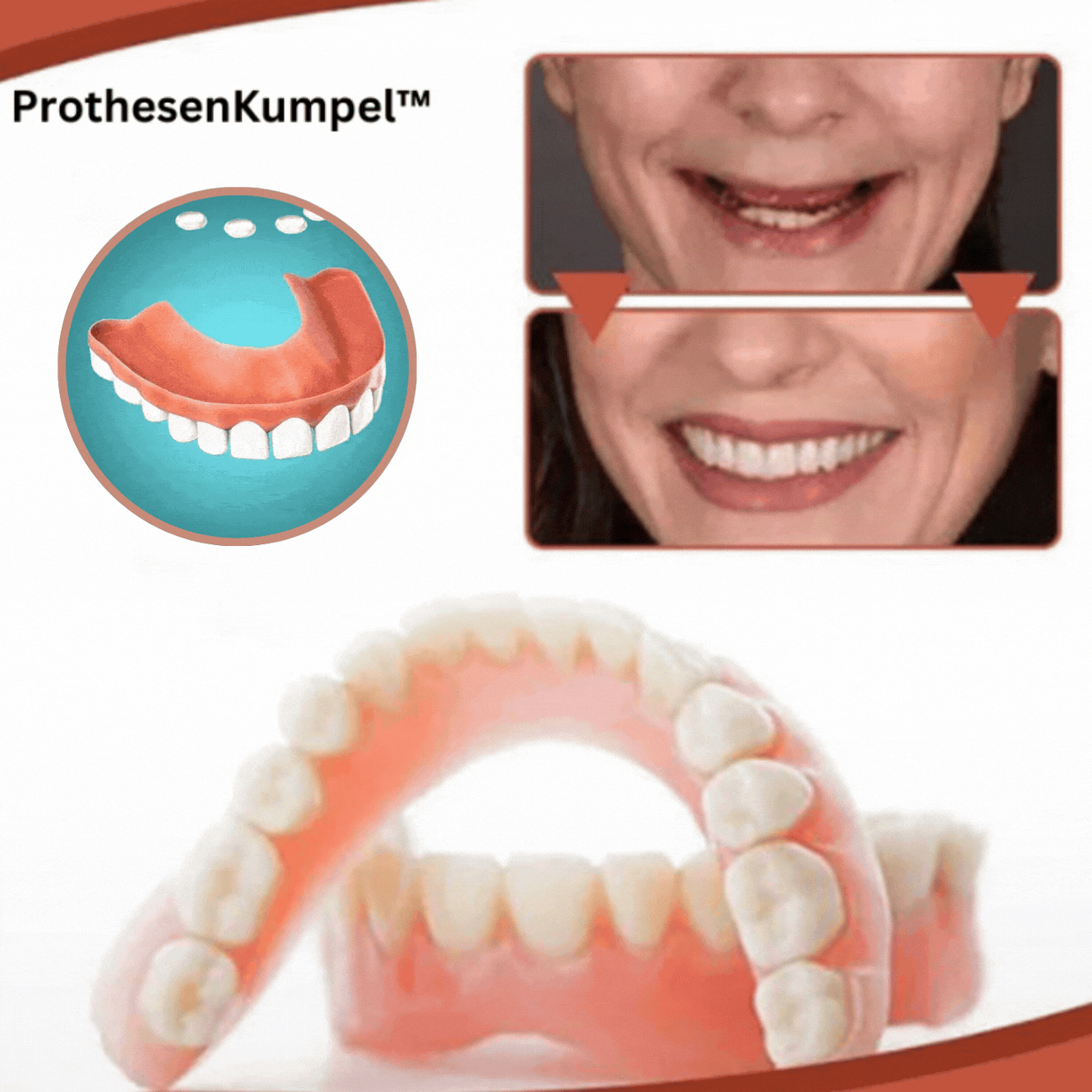 BowLift | Biocompatible Prosthesis Set for Pain-Free Fit and Natural Smile