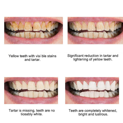 Whitening Dental Gel Pen