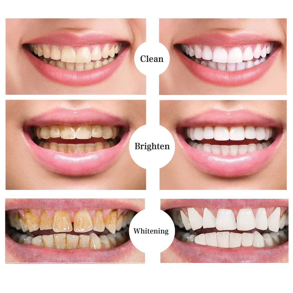 Whitening Dental Gel Pen