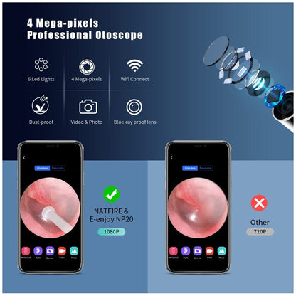 Wireless Otoscope Ear Wax Removal Tool, 1080P HD